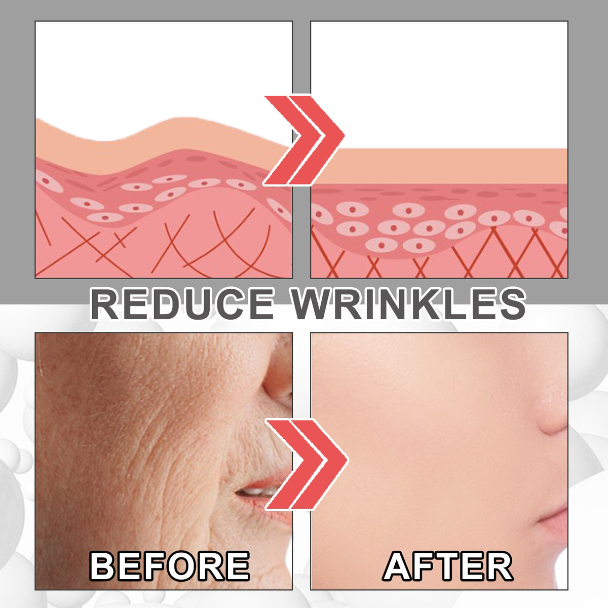 Anti Wrinkle Cream