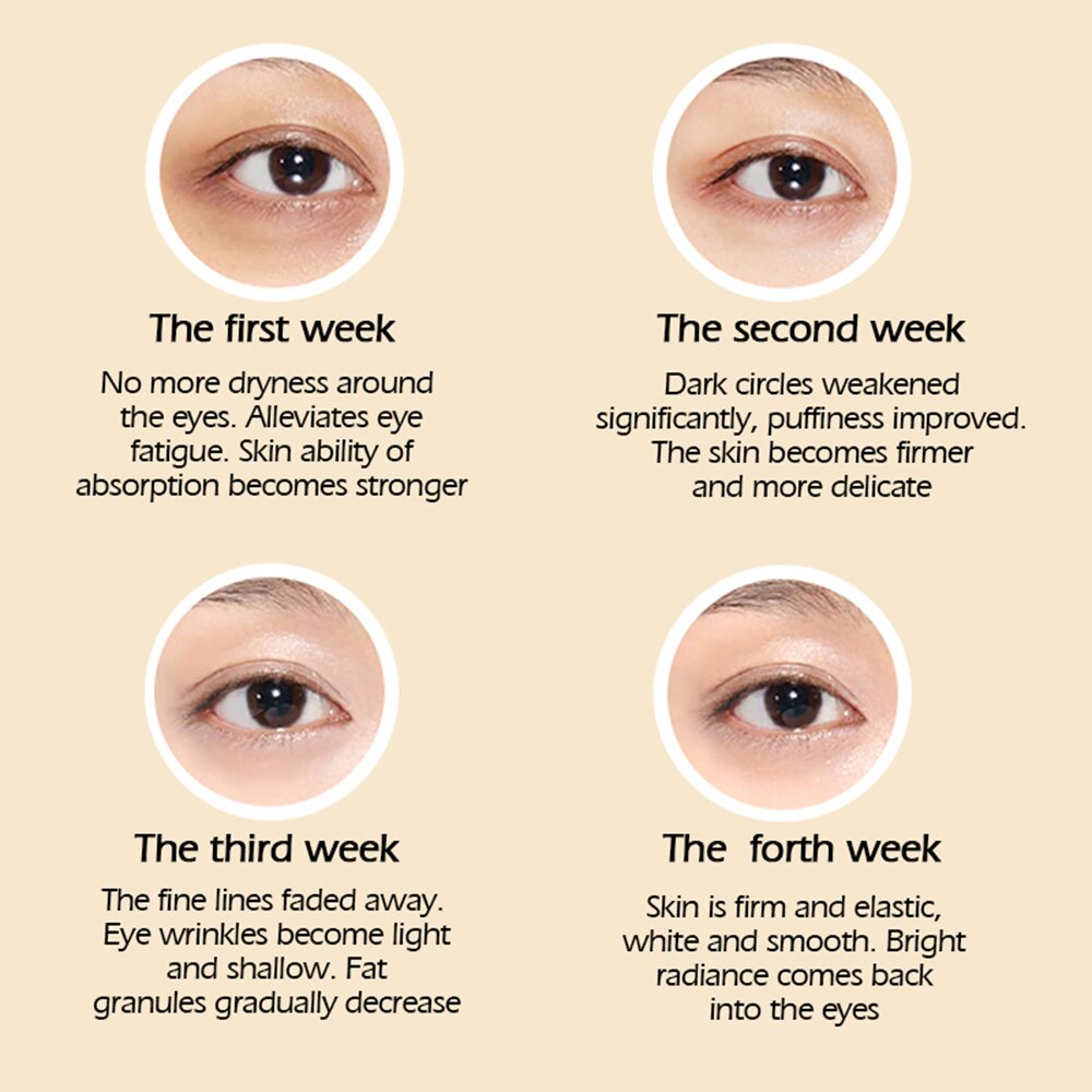 Eye Cream Removal Dark Circle