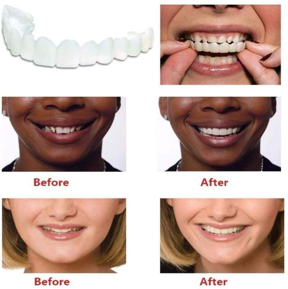 -Generation Silicone Simulation Teeth Dentures