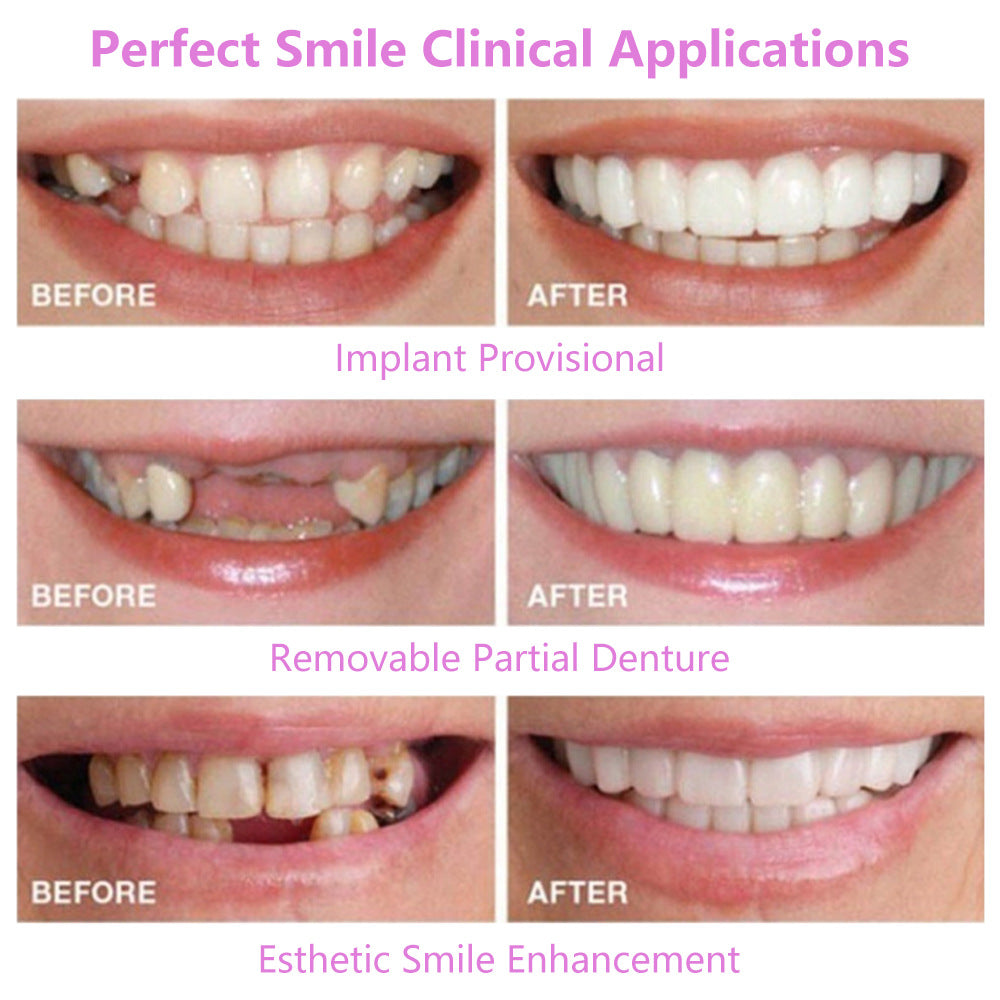 -Generation Silicone Simulation Teeth Dentures