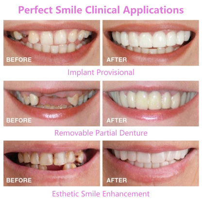 -Generation Silicone Simulation Teeth Dentures